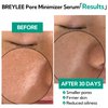 Pore Minimizer Serum， BREYLEE Pore Refining Serum for Face & Nose, Oil Control Firming, Shrinking Pore & Tightening Skin, Pore Moisture after Blackhead Remover, Clam and Soothing Skin Care