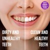 Sprinjene Fluoride Free Toothpaste for Sensitive Teeth & Gum - All Natural Toothpaste Fluoride Free Toothpaste Adult, SLS Free, Non Fluoride Toothpaste Adult - 2 Pack Patented Toothpaste Floride-Free
