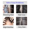 Luolihar Hair Topper for Women Real Human Hair No Bangs Upgrade Lace Base Human Hair Topper for Women with Thinning Hair Clip in Top Hair Extensions Top Hair Pieces for Women Light Brown 10 Inch