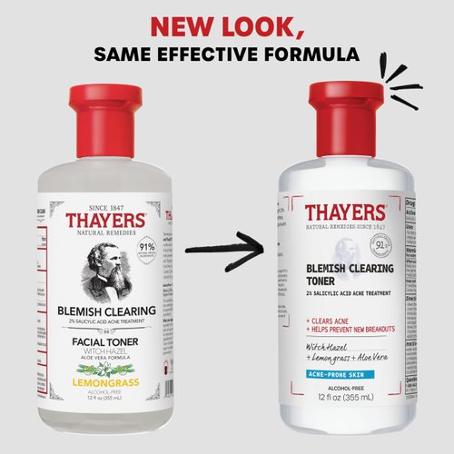 Thayers Blemish Clearing Salicylic Acid Toner, Acne Treatment Face Toner with 2% Salicylic Acid, Soothing and Non-Stripping Skin Care, 12 Fl Oz (Packaging May Vary)