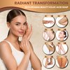 RB REHANA BEAUTY Kojic Acid Soap for Hyperpigmentation, Dark Spot Remover for Body & Face, Acne Cleanser, Lemon Turmeric Brightening Soap with Vitamin C (3x100g Bars + 2 Nets), For both Women & Men