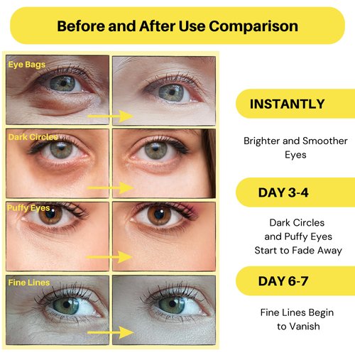 Lookix Collagen Under Eye Patches - Anti-Aging, Dark Circle & Puffy Eye Treatment - Hydrates and Firms Skin - 30 Pairs