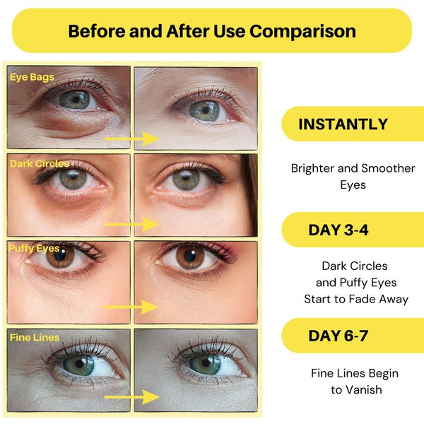 Lookix Collagen Under Eye Patches - Anti-Aging, Dark Circle & Puffy Eye Treatment - Hydrates and Firms Skin - 30 Pairs