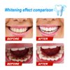 Press Toothpaste,Baking Soda Whitening Toothpaste,Jaysuing Stain Removal Whitening Toothpaste Strong Cleaning Power Natural Stain Remover Fluoride-Free Toothpaste（Blueberry Flavor）