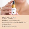 ISDIN Melaclear, Dark Spot Correcting Serum with Vitamin C and Phytic Acid, Suitable for Sensitive Skin…