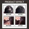 Hair Fibers for Thinning Hair - Light & Thick Hairline Powder Long-Lasting Adsorption Hair Texture Powder Hair Root Touch Up Fibers Waterproof and Windproof Hair Powder for Men&Women (Black)