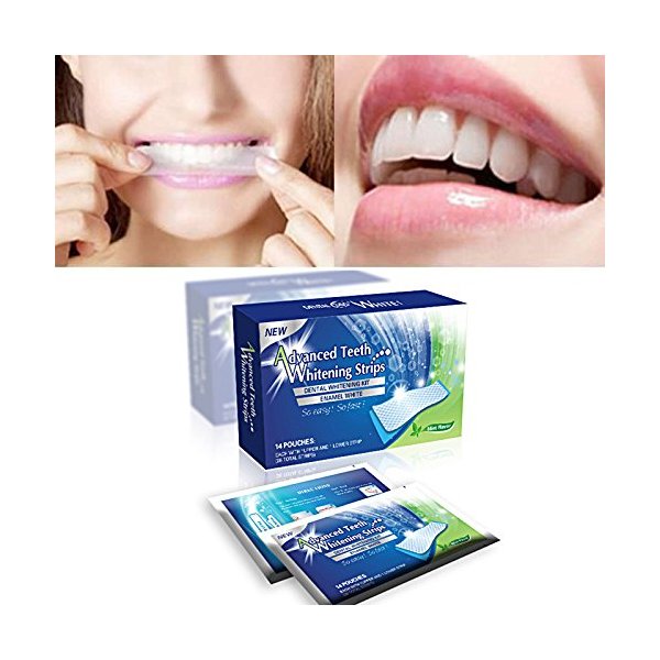 Sparkling White Smiles Advanced Teeth Whitening Strips 28 Count(14 Upper and 14 Lower Strips) Compare to Major Brands and Save.