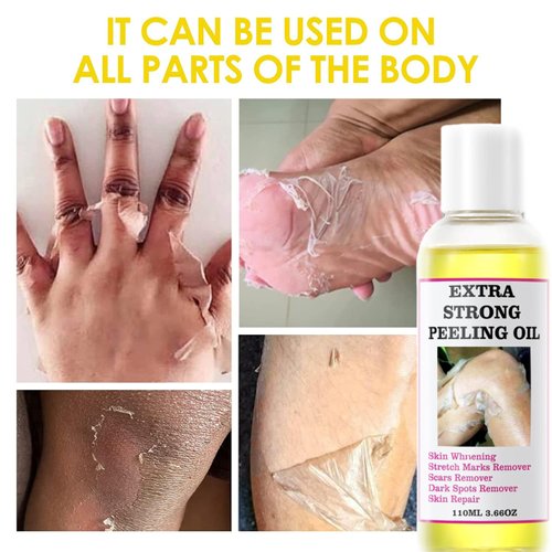 Yellow Extra Strong Chemical Peeling Oil, Chemical Peel Oil for Dark Skin, Exfoliating Peeling Solution for Body All Skin Type 110 ML/3.66 FI OZ