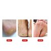 Callus Shaver Remover Stainless Steel Callus Trimmers Hard Skin Dry Skin Remover Calluses Planer Pedicure Foot File Tool Foot Care Tools()