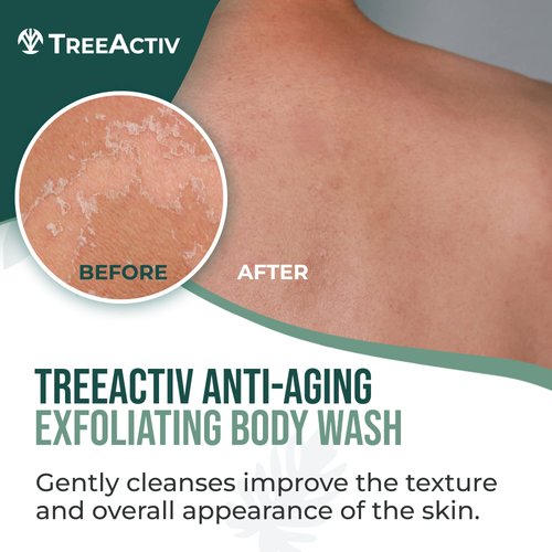 TreeActiv Anti-Aging Exfoliating Body Wash, 8oz, All Natural Body Wash Women and Men, Exfoliating Body scrub Infused with Jojoba Beads, Sulfur, and Aloe Vera - Shower Gel For All Skin Types - 50 Uses