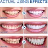 Niacinamide Whitening Toothpaste, Easilyous Radiant Whitening Toothpaste,Fresh Breath,Remove Tooth Stains, 2 Pack