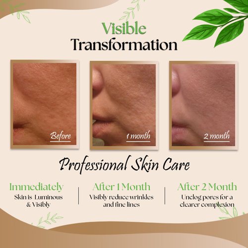 Rejuvenating Facial Night Cream with Retinol, Tepezcohuite, Niacinamide - cruelty-free, vegan, paraben-free silicone-free Mexican Natural skincare ingredients