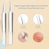 Blackhead Remover Pimple Popper Tool Kit, 6-in-1 Blackhead Comedone Acne Blemish Pimple Extractor Tool Kit Tweezers Kit Skin Care Tools for Face