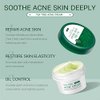 AKARY Tea Tree Oil Face Cream Acne Cream - for Oily, Acne Prone Skin, Extra Soothing & Nourishing Non-Greasy Botanical Facial Moisturizer, Acne Removal, Gently Repair For Acne Skin, Cystic Acne, Pimple & Redness