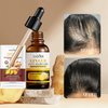 Sadoer Ginger Anti-Hair Loss Oil and Shampoo, Sadoer Ginger Hair Growth Serum + Shampoo, Sadoer Ginger Extract Anti-Hair Loss Treatment Essence Set for Thicker, Stronger, Longer Hair Men & Women (1)