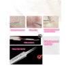 Professional Facial Blackhead Remover Tweezers,Extractor Acne Removal Kit Pimple Popper Tool, Clip for Whiteheads, Acne Clip, Ingrown Hairs Tweezers, Blackheads Remover Extractor, Stainless Steel
