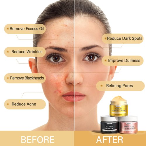 YLNALO Turmeric Vitamin C Clay Mask, Dead Sea Mud Mask, and Himalayan Clay Mask, Facial Skin Care Set for Deep Pore Cleansing, Reduce Blackheads Acne, Dark Spots, Oil Control, and Radiant Skin