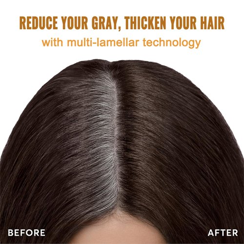 Fedulili Instant Dark Brown Hair Dye Shampoo 3 In 1,100% Gray Hair Coverage Root Touch Up 4 Weeks,Bubble Hair Color Shampoo Colors In 15 Minutes,Simpler Hair Color Multi-Use,Shampoo Para Canas