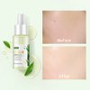 AKARY Green Tea Face Serum Moisturizing & Hyaluronic Acid Oil Control Skin Soothing Skincare Shrink Pores Serum, Natural Facial Serum for Skin Care Breakout Pimple Cutin Repair