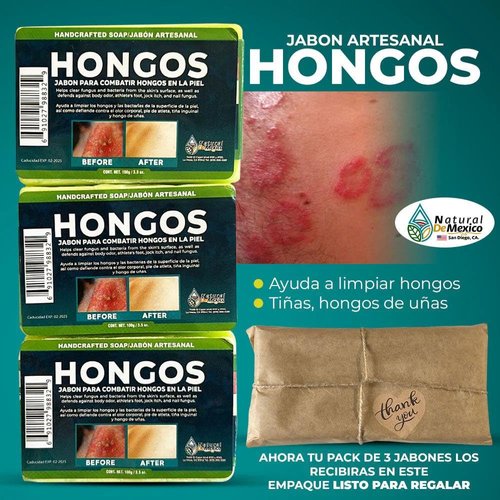 Hongos Jabon 3 Pack Anti Fungal Soap Bar Fungus