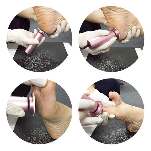 Dr.Pedi Callus Remover for Feet Electric Foot (Speed Adjustable) with 60pcs Replacement Sandpaper Discs Professional Pedicure Foot File for Women Men Dead Dry Hard Skin Calluses Pink