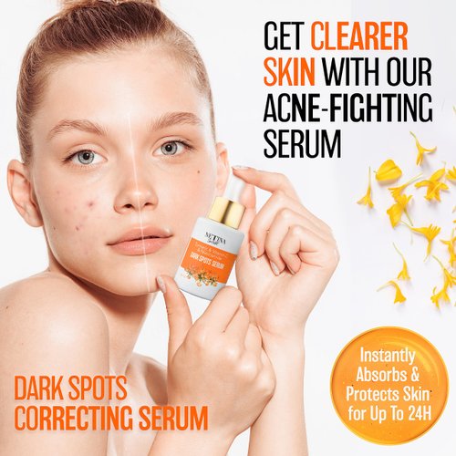 NETINA Skin Restart Dark Spot Serum - Turmeric, Niacinamide, Vitamin C, 30 mL
