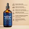 Nexon Botanics Amla Rosemary Hair Oil 4 fl Oz - Nourishing Rosemary Oil for Hair Growth - Mint, Castor, Tea Tree - Hair Growth Oil for Damaged Hair, Curly Hair, Frizzy Hair, Dry Scalp - Men, Women