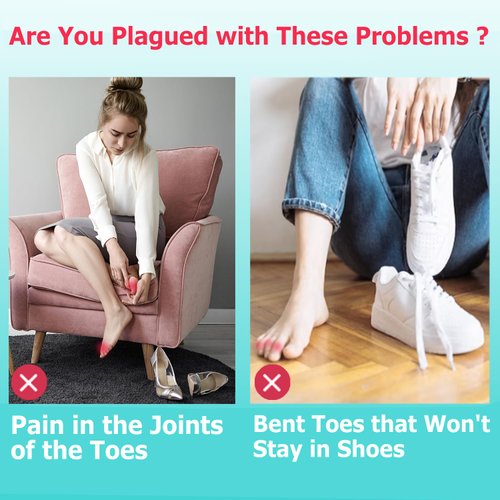 Byehambuni Toe Straightener - Hammer Toe Corrector for Women and Men - Toe Straighteners for Curled, Crooked, Bent Toe - Hole Diameter 0.55 inches - Beige, 6PCS Medium Size