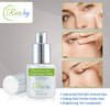 Rare Ivy Rejuviderm Eye Brightening Cream- Eye Cream for Dark Circles and Puffiness - Undereye Moisturizer Anti Aging Cream- Removes Wrinkles Fine Lines (0.5 FL OZ / 15 ML)