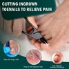 FVION Toenail Clippers for Thick Nails - Nail Clippers Toenail Nipper, Wide Jaw Nail Trimmer, Slight Curved Blade Pointed Tip Ingrown Toenail Tool