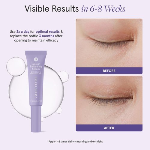 iRESTORE Eyelash Growth Serum | Vegan Prostaglandin Free & Non Irritating | For Thicker, Fuller, Longer and Gorgeous Eye Lashes | Lash Enhancing Serum | 3 Month Supply 5ml