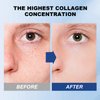 4PCS Deep Collagen Overnight Mask, Collagen Face Mask Deep Collagen Anti Wrinkle Lifting Mask Collagen Face Mask Overnight, Wash Free Collagen Films Lifting Mask for Face