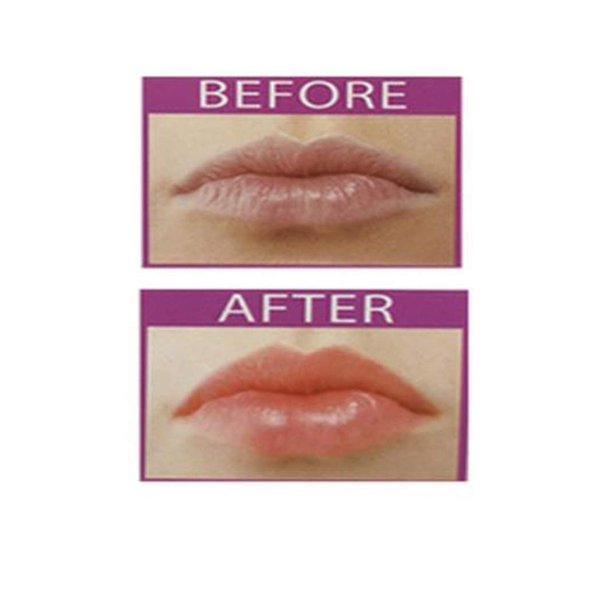 Prestige Biatta Lip Plumper Plumping Gloss Tint And Shine For Fuller Lips (4- Light Pink)