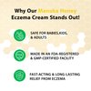 DERMOIA Manuka Honey Cream - Eczema Cream for Adults & Kids - Seborrheic Dermatitis Cream for All Skin Types - Eczema Honey Cream for Redness & Itch Skin Relief with Aloe Vera - 4oz