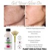 Planet Eden 30% Glycolic Acid Chemical Skin Peel Kit with Antioxidant Recovery Cream and Fan Brush Diminish sun damage