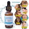 Vitamin C Serum for Face with Hyaluronic Acid, Skin Brightening Anti Aging Serum for Face, Vita C Dark Spot Serum, Made in the USA by Natuderma,1Fl Oz,