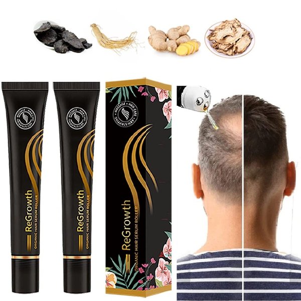 2 Pcs Organic Hair Roller, Herbal Ball Massage for Hair Growth, Thicker Hair, Receding Hairline & Pattern Baldness