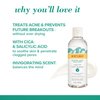 Burt's Bees Natural Acne Solutions Purifying Gel Cleanser, Salicylic Acid Acne Treatment with Soothing Cica, 98% Natural Origin, 5 Fluid Ounces (Package May Vary)