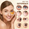 Aivoch 20Pairs/40Pcs 24K Gold Eye Patches, Collagen Eye Masks for Dark Circles and Eye Bags, Smooth Wrinkles & Puffy Eyes, Moisturizing Eye Skin, Skincare Eye Treatment, Beauty & Personal Care