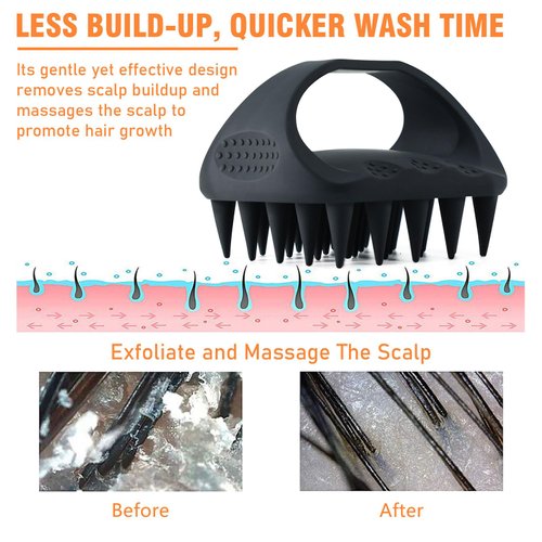 YEALIR Scalp Massager Shampoo Brush, Scalp Scrubber for Dandruff & Build Up, Bigger Coverage Shorter Washing Time, Scalp Massager Hair Growth w/Silicone Bristles| Easy to Hold