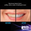 DentaPro2000 Professional Teeth Whitening Strips Dentist Certified at Home Teeth Whitener Enamel Safe See Results Instantly Safe Tooth Whitening 28 Ct