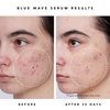 HERBIVORE Blue Wave Clearing Serum Acne Treatment – 2% Salicylic Acid + Blue Tansy + Willow Bark, Plant-based, Vegan, Cruelty-free, 30mL /1 oz