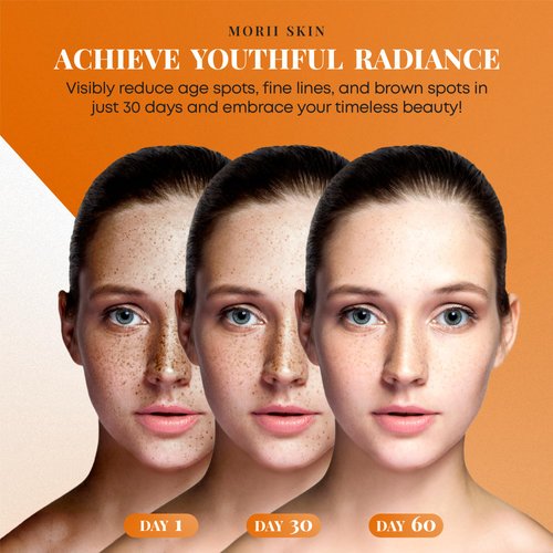 Organic Turmeric Soap Bar for Face, Kojic Acid Soap for Hyperpigmentation, Premium Japanese Formulated Kojic Soap Enriched with Vitamin C, Retinol, Collagen, Hyaluronic Acid, Shea Butter (2 Pack)