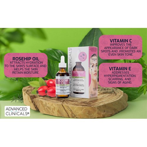 Advanced Clinicals Rosehip Oil For Face | Anti Wrinkle Facial Skin Care Serum | Vitamin C Serum Moisturizer Face Oil W/Vitamin E For Fine Lines, Dark Spots, Uneven Skin Tone, & Sun Damage, 1.8 Fl Oz