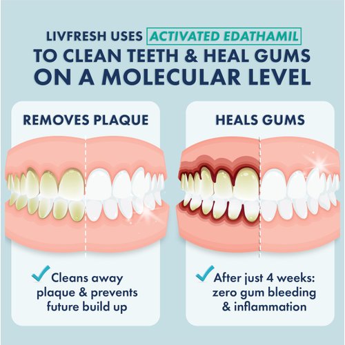 LIVFRESH Gel Toothpaste - Clinically Proven, SLS-Free, Peppermint Flavor, Non-Foaming, Safe for All Ages, Removes Plaque 250%, Improves Gum Health 190%, Reduces Tartar