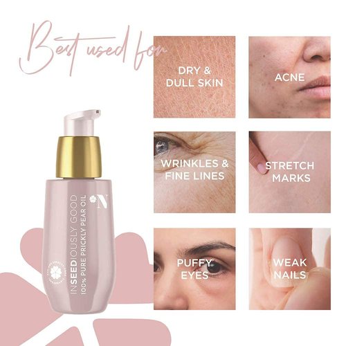 Beauty Nut 100% Organic Prickly Pear Seed Oil Luxury Edition. Anti-aging Oil, Moisturizes, Restore Elasticity, Minimize Varicose Veins and Dark Circles 30ml