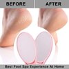 2 Pack Nano Glass Foot File Callus Remover, Beomeen Hard and Dead Skin Remover for Feet, Double Sided Foot Scrubber Hygienic Pedicure Tool, Hair Eraser for Softer and Smoother Feet and Hands