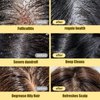Anti-Dandruff and Antifungal Shampoo - Treats Folliculitis, Seborrheic Dermatitis, Psoriasis - Relieves Itchy, Dry Itchy Scalp Treatment, For Normal to Oily Scalp Prone to Folliculitis, 8 fl. oz.- 2