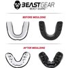 Beast Gear Sports Mouth Guard - Adult and Youth Gum Shield for Boxing, Football, Lacrosse, Basketball, Rugby, MMA - Mouthguard Sports Accessories for Men, Women & Kids