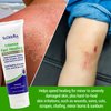 TriDerma Intense Fast Skin Healing Cream for Hard-to-Heal Skin Irritations, Sores, Rashes, Dry, Cracked Hands, Cuts, Chafing, Burns, Scrapes - First Aid Kit Essential - FSA Eligible - 4.0 oz Tube